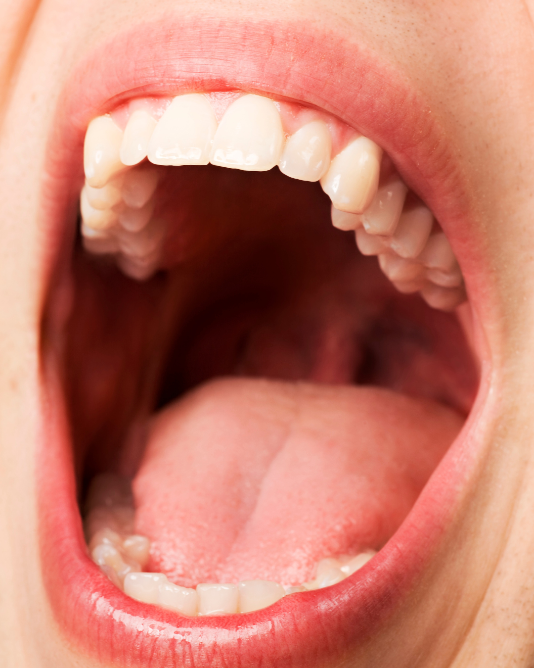 Nahaufnahme eines offenstehenden Mundes mit sichtbaren weißen Zähnen, roter Zunge und rosafarbenen Lippen